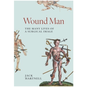 Wound Man: The Many Lives of a Surgical Image