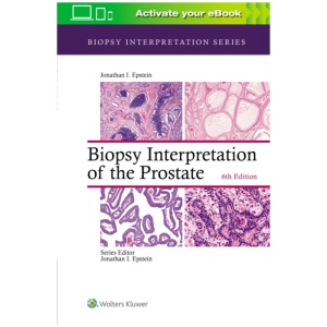 Biopsy Interpretation of the Prostate