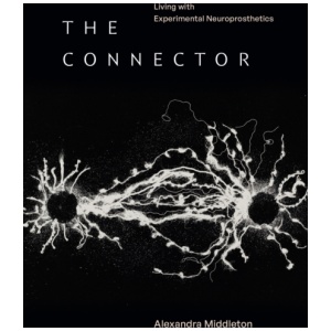 The Connector: Living with Experimental Neuroprosthetics