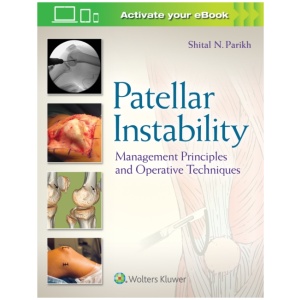 Patellar Instability: Management Principles and Operative Techniques